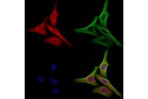 ABIN6265290 and ABIN6273077 staining Hela cells by IF/ICC. (SRP9 抗体  (Internal Region))