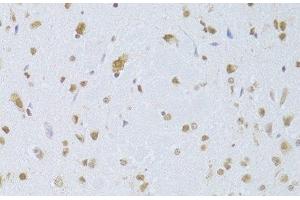 Immunohistochemistry of paraffin-embedded Mouse brain using CDKN1A Polyclonal Antibody at dilution of 1:100 (40x lens). (p21 抗体)