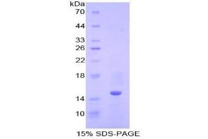SDS-PAGE analysis of Human Cystatin B Protein. (CSTB 蛋白)