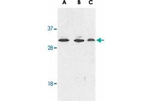 Western blot analysis of RYBP expression in human A-549 (lane A), HepG2 (lane B), and mouse NIH/3T3 (lane C) cell lysates with RYBP polyclonal antibody  at 1 ug /mL . (RYBP 抗体  (AA 215-228))