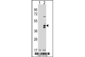 Western blot analysis of RCL1 using rabbit polyclonal RCL1 Antibody using 293 cell lysates (2 ug/lane) either nontransfected (Lane 1) or transiently transfected (Lane 2) with the RCL1 gene. (RCL1 抗体  (N-Term))