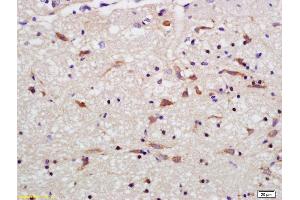 Formalin-fixed and paraffin embedded rat brain labeled with Rabbit Anti OPA1 Polyclonal Antibody, Unconjugated (ABIN1387244) at 1:200 followed by conjugation to the secondary antibody and DAB staining (OPA1 抗体  (AA 651-750))