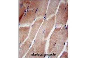 RPL5 Antibody (N-term) (ABIN653209 and ABIN2842750) immunohistochemistry analysis in formalin fixed and paraffin embedded human skeletal muscle followed by peroxidase conjugation of the secondary antibody and DAB staining. (RPL5 抗体  (N-Term))