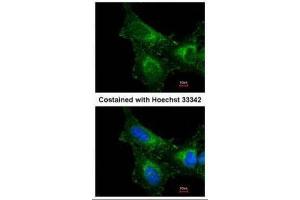 ICC/IF Image Immunofluorescence analysis of methanol-fixed HeLa, using PRX I, antibody at 1:200 dilution. (Peroxiredoxin 1 抗体)