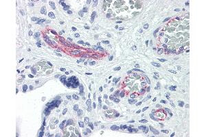 Anti-RND3 antibody IHC of human placenta. (RND3 抗体  (AA 1-245))