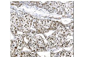 IHC analysis of EHMT2/G9A using anti-EHMT2/G9A antibody (ABIN7602084). (EHMT2 抗体  (AA 580-1195))