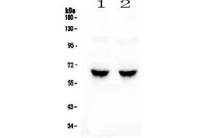 Western blot analysis of GAD65 using anti-GAD65 antibody .