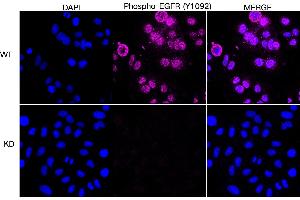 Immunocytochemical staining of HepG2 cells using Phospho-EGFR (Y) antibody (ABIN7798468), 1:1,000), Top panel: wild-type (WT), Bottom panal: Phospho-EGFR (Y) shRNA knockdown (KD). (Recombinant EGFR 抗体  (pTyr1068))