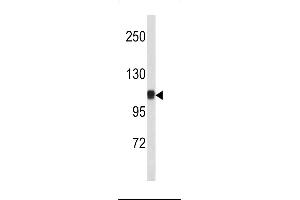 Western Blotting (WB) image for anti-Catenin (Cadherin-Associated Protein), alpha 1, 102kDa (CTNNA1) (AA 30-59), (N-Term) antibody (ABIN390505)