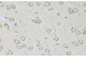 Immunohistochemistry of paraffin-embedded Rat brain using RPL13 Polyclonal Antibody at dilution of 1:100 (40x lens). (RPL13 抗体)