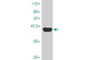 Western Blot detection against Immunogen (40. (FAK 抗体  (AA 355-490))