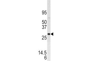 Western Blotting (WB) image for anti-Dual Specificity Phosphatase 3 (DUSP3) antibody (ABIN3003774) (Dual Specificity Phosphatase 3 (DUSP3) 抗体)