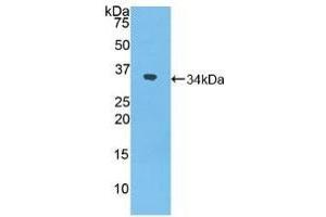 Detection of Recombinant NXN, Mouse using Polyclonal Antibody to Nucleoredoxin (NXN)