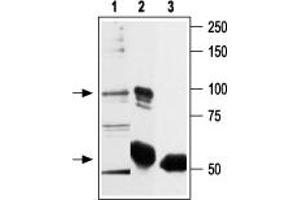 Immunoprecipitation (IP) image for anti-Transient Receptor Potential Cation Channel, Subfamily V, Member 2 (TRPV2) (AA 735-750), (Intracellular) antibody (ABIN7043842)