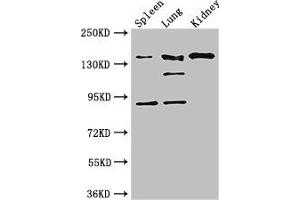 Western Blot Positive WB detected in: Mouse spleen tissue, Mouse lung tissue, Mouse kidney tissue All lanes: NOS1 antibody at 3 μg/mL Secondary Goat polyclonal to rabbit IgG at 1/50000 dilution Predicted band size: 161, 149, 126, 44, 165 kDa Observed band size: 161, 126, 92 kDa (NOS1 抗体  (AA 655-875))