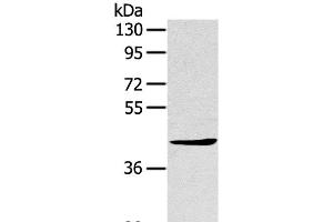 Western Blot analysis of A431 cell using TNIP2 Polyclonal Antibody at dilution of 1:500 (TNIP2 抗体)