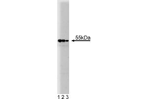Western Blotting (WB) image for anti-Prolyl 4-Hydroxylase, beta Polypeptide (P4HB) (AA 109-214) antibody (ABIN968268) (P4HB 抗体  (AA 109-214))