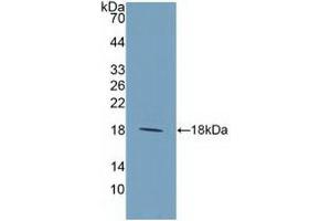 Detection of Recombinant IL9, Human using Polyclonal Antibody to Interleukin 9 (IL9) (IL-9 抗体  (AA 19-144))