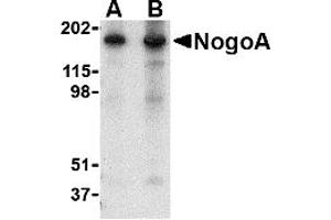 Western Blotting (WB) image for anti-Reticulon 4 (RTN4) (N-Term) antibody (ABIN1031486)