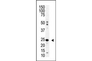 Western Blotting (WB) image for anti-SUMO/sentrin Specific Peptidase Family Member 8 (SENP8) (AA 4-35), (N-Term) antibody (ABIN388073)