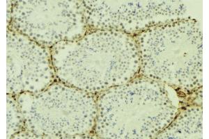 ABIN6277175 at 1/100 staining Mouse testis tissue by IHC-P. (UBE2I 抗体  (N-Term))
