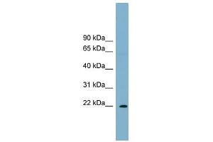 PCNP antibody used at 1 ug/ml to detect target protein.