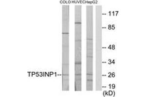 Western blot analysis of extracts from COLO205/HuvEc/HepG2 cells, using TP53INP1 Antibody. (TP53INP1 抗体  (AA 171-220))
