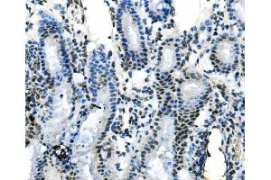 IHC analysis of IRF1 using anti-IRF1 antibody (ABIN7600281).