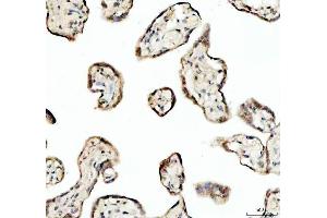 IHC analysis of SP6 using anti-SP6 antibody (ABIN5692945). (SP6 抗体)