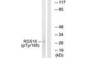 Western blot analysis of extracts from COS7 cells treated with heat shock, using RGS16 (Phospho-Tyr168) Antibody. (RGS16 抗体  (pTyr168))