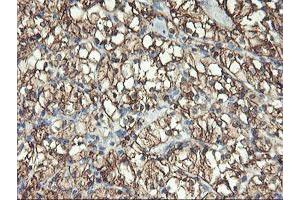 Image no. 2 for anti-Glutamyl Aminopeptidase (Aminopeptidase A) (ENPEP) antibody (ABIN1498029) (ENPEP 抗体)