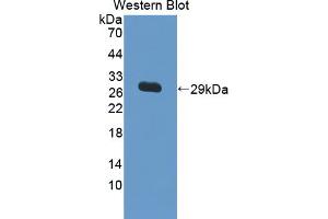 Western blot analysis of the recombinant protein. (IL17RC 抗体  (AA 257-477))