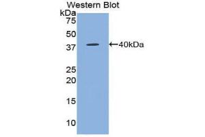 Western Blotting (WB) image for anti-Chemokine (C-C Motif) Ligand 5 (CCL5) (AA 24-91) antibody (ABIN3209288) (CCL5 抗体  (AA 24-91))