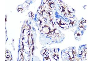Immunohistochemistry of paraffin-embedded human placenta using Caldesmon Rabbit mAb (ABIN7266024) at dilution of 1:100 (40x lens). (Caldesmon 抗体)