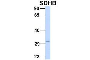 Western Blotting (WB) image for anti-Succinate Dehydrogenase Complex, Subunit B, Iron Sulfur (Ip) (SDHB) (Middle Region) antibody (ABIN2783181)