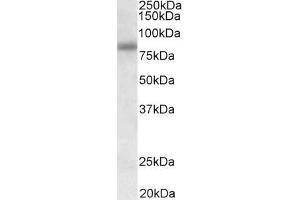 SDCCAG8 抗体  (Internal Region)