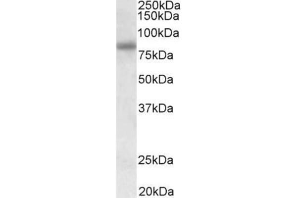 SDCCAG8 抗体  (Internal Region)