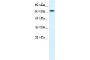 Western Blotting (WB) image for anti-Potassium Intermediate/small Conductance Calcium-Activated Channel, Subfamily N, Member 2 (KCNN2) antibody (ABIN2461098) (KCNN2 抗体)