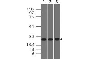 Image no. 1 for anti-ES cell expressed Ras (ERAS) (AA 1-210) antibody (ABIN5027194) (ERAS 抗体  (AA 1-210))