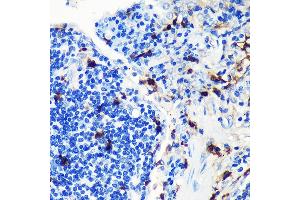 Immunohistochemistry (IHC) image for anti-S100 Calcium Binding Protein A8 (S100A8) antibody (ABIN7270128)