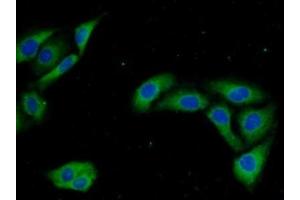 Detection of UCN2 in Human U2OS Cells using Monoclonal Antibody to Urocortin 2 (UCN2) (Urocortin 2 抗体  (AA 20-112))