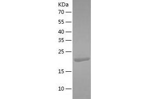 PDCL3 Protein (AA 1-239) (His tag)