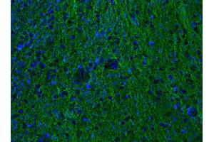 Indirect immunostaining of PFA-fixed mouse brain section (dilution 1 : 500; green). (alpha Tubulin 抗体  (AA 419-435))