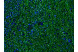 Indirect immunostaining of PFA-fixed mouse brain section (dilution 1 : 500; green).