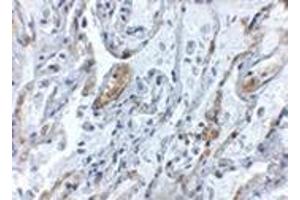 Immunohistochemistry of TNFAIP3 in human lung tissue with this product at 5 μg/ml. (TNFAIP3 抗体  (Center))