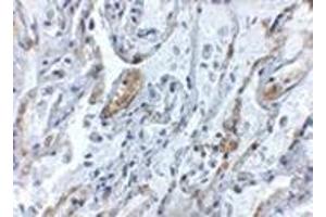 Immunohistochemistry of TNFAIP3 in human lung tissue with this product at 5 μg/ml. (TNFAIP3 抗体  (Center))