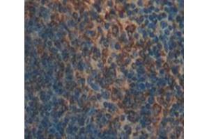 Used in DAB staining on fromalin fixed paraffin- embedded Kidney tissue (CD93 抗体  (AA 427-644))