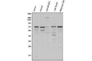 Western blot analysis of POT1 using anti-POT1 antibody (ABIN3043444). (POT1 抗体  (N-Term))