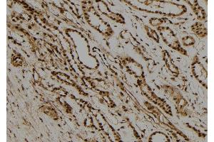 ABIN6277733 at 1/100 staining Human kidney tissue by IHC-P. (RAD21 抗体  (C-Term))