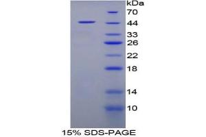 SDS-PAGE analysis of Pig FABP4 Protein. (FABP4 蛋白)